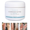 Cubed 4.5 oz Eczema Cream für Erwachsene, Eczema Relief, Eczema Behandlung, Moisturize Dry Irridated Skin, Smart Lotion für topische Steroid-Entnahme Symptome, Psoriasis & Rosacea, Eczema, Dermatitis