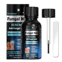 Nagelpilzbehandlung, Nagelpilzbehandlung für Nagel, Nagelreparaturlösung, Fingernägel Erneuerbare Flüssigkeit für beschädigte und verfärbende Nail, Nagelpilzbehandlung, sicher und gesund - 30ML (1 FLOZ)