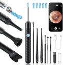 Loyker X6 Ear Wax Removal Tool Kamera, Ohr Reiniger mit Kamera, FSA - HSA Store Eligible, 1080P Ohr Kamera mit 6LED Licht für Ohr/Nose/Throat/Tonsil Stein Prüfung, Schwarz