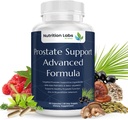 Prostate Health Support Kräuterergänzung für Männer mit Beta Sitosterol, Selen, Pygeum und Saw Palmetto Extrakt für Prostataunterstützung und häufige Urination - 90 CT
